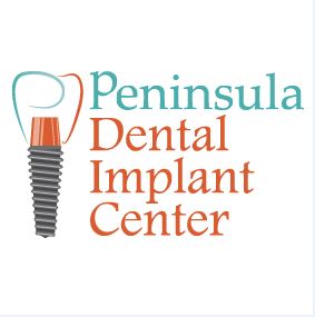 Good Dental implants in San Carlos