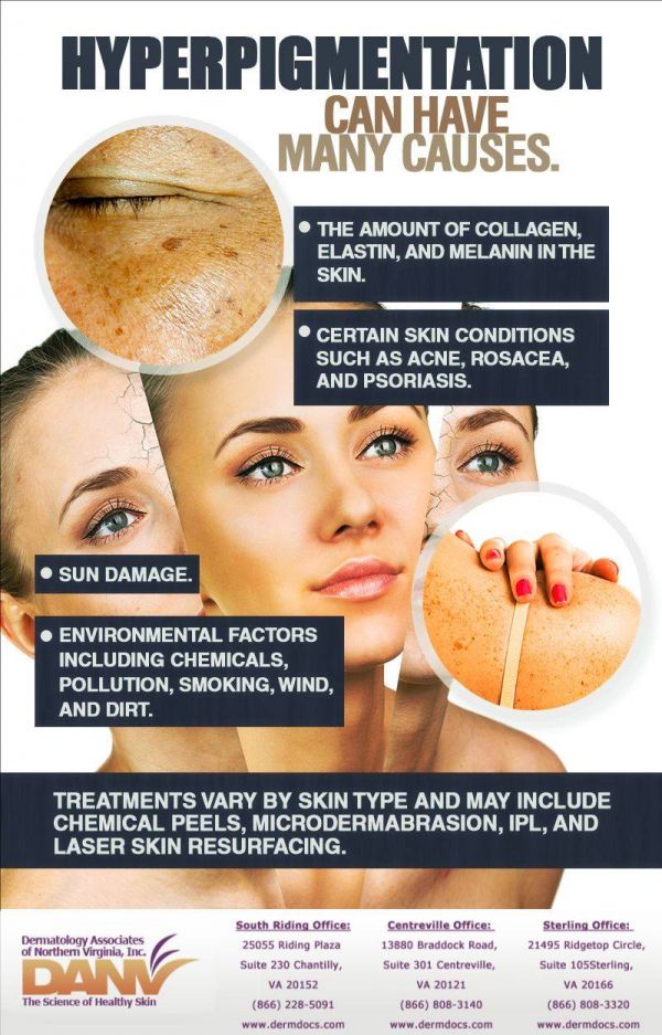 Dr. Neeraj Mattay Affordable Acne Treatment in Centreville - 20122