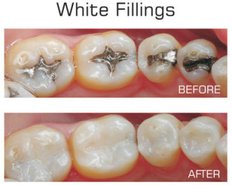 Recommended Cosmetic Dentistry Waterford, MI