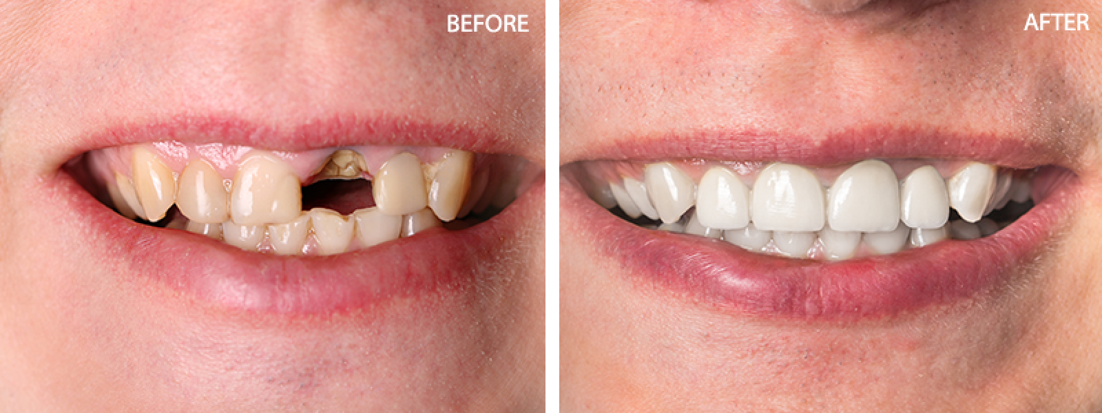 Dr. Mohammed M. Imam Affordable Root Canal Treatment  in Skowhegan- 04976