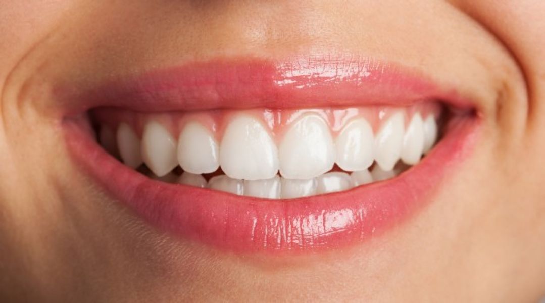 Get A Perfect Smile With Cosmetic Dentistry In Ausin TX 