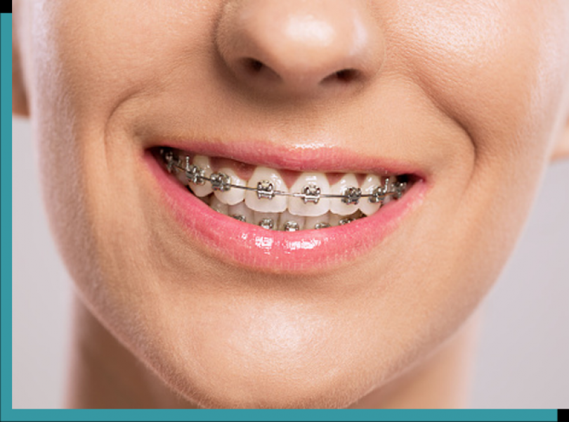 Local Orthodontics Rancho Cucamonga - Dr. Mario Castellanos For Best Results 