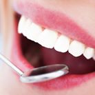 Affordable Porcelain Veneers Turlock