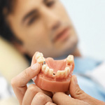 Local Dental Implants in Sterling Heights