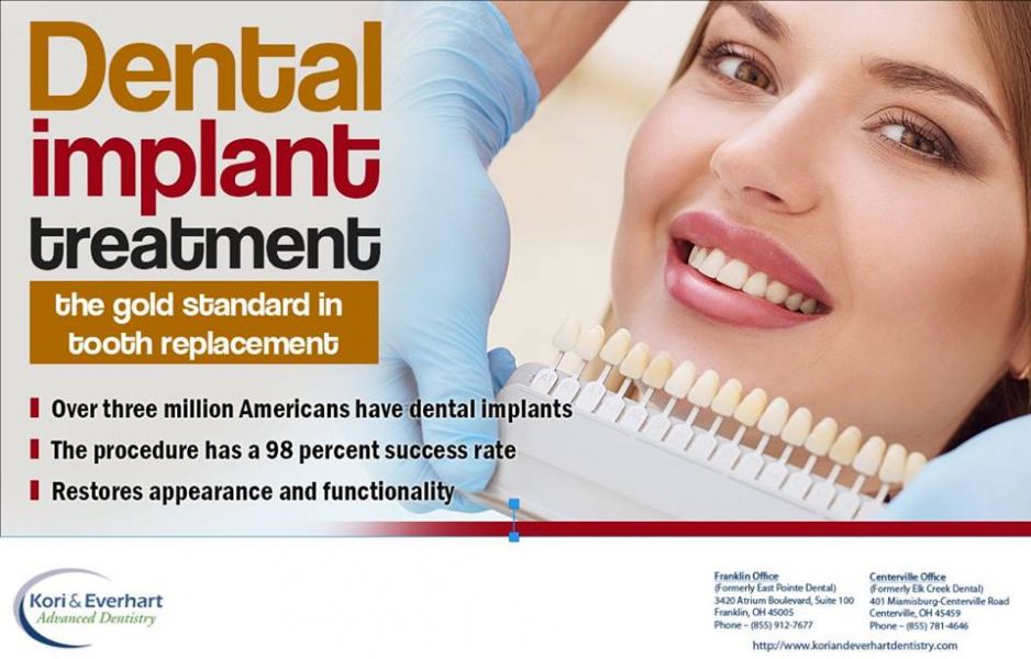 Certified Dental Implants Franklin OH - Dr. Mamta Kori