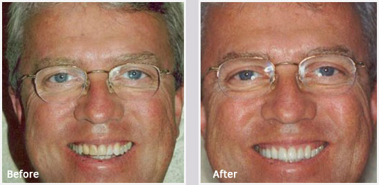 Functional Orthodontics in Greenville SC