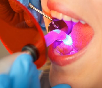 Dr. Sakunthala Boppana - Recommended Local Dental Bonding Garland TX - 75044 