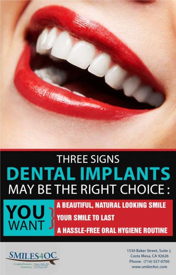 Looking For Local Dental Implants Costa Mesa ? Visit Dr. Thomas Rolfes 
