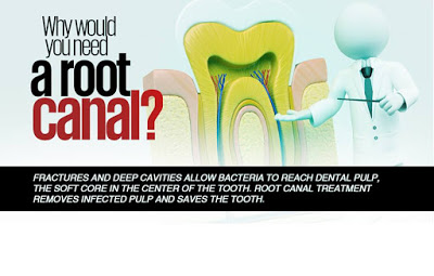 Recommended Root Canal Therapy Sterling Heights, MI 