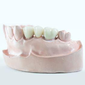 Dr. Sakunthala Boppana Affordable Dental Bridge in Garland TX - 75044 