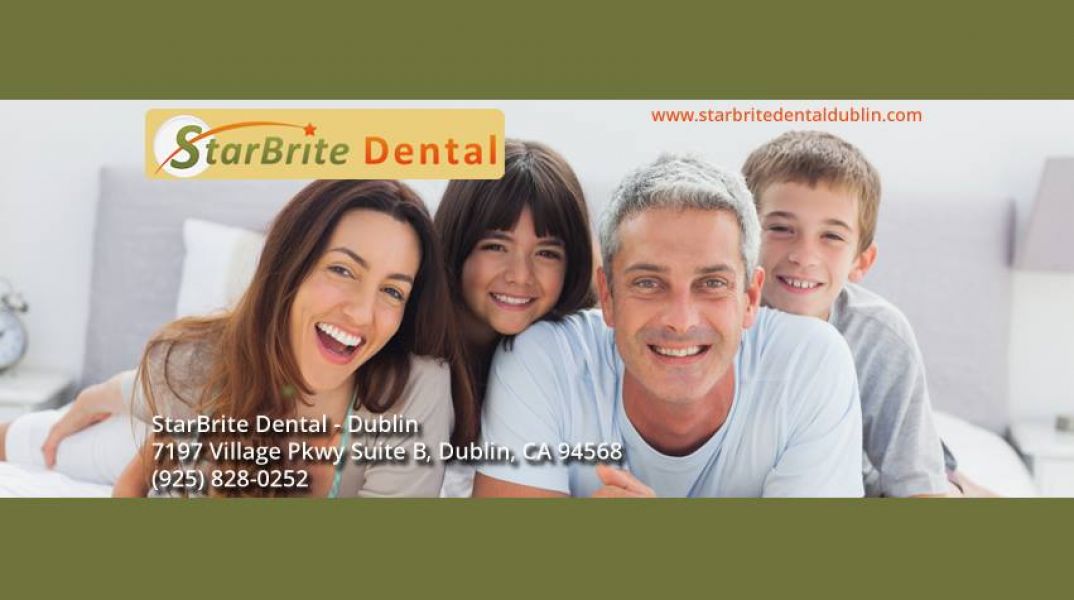 Recommended Teeth Whitening Dublin CA - www.starbritedentaldublin.com/teeth-whitening/ 