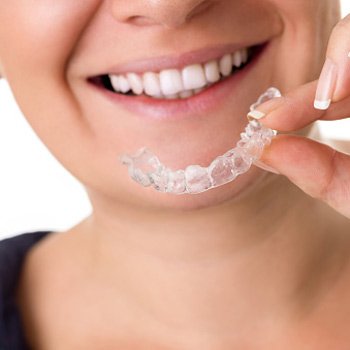 Visit Dr. Glenn Belen - Best Results Invisalign� San Mateo, CA 