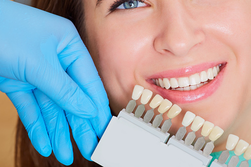 Teeth Whitening 29407- Mouth Carolina dentistry