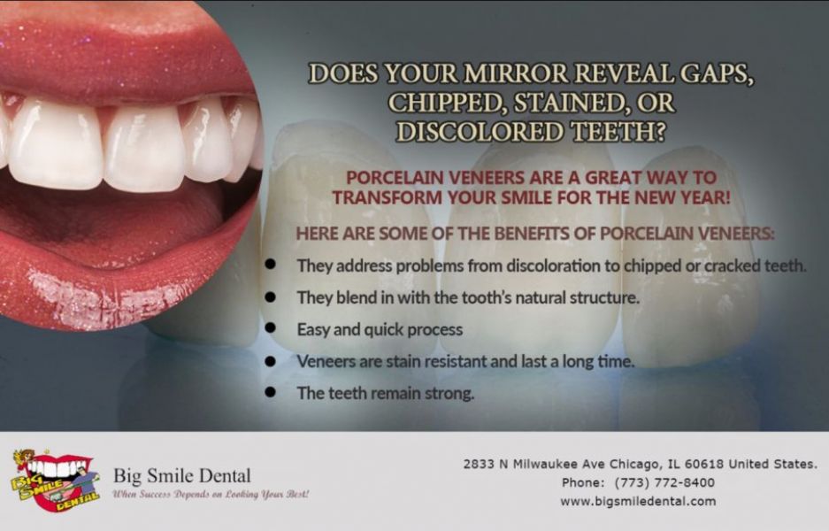Dr. Theodore M. Siegel Affordable Porcelain Veneers in Chicago - 60618