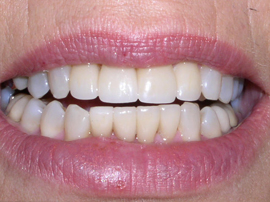 Williamsburg Cosmetic Dentistry