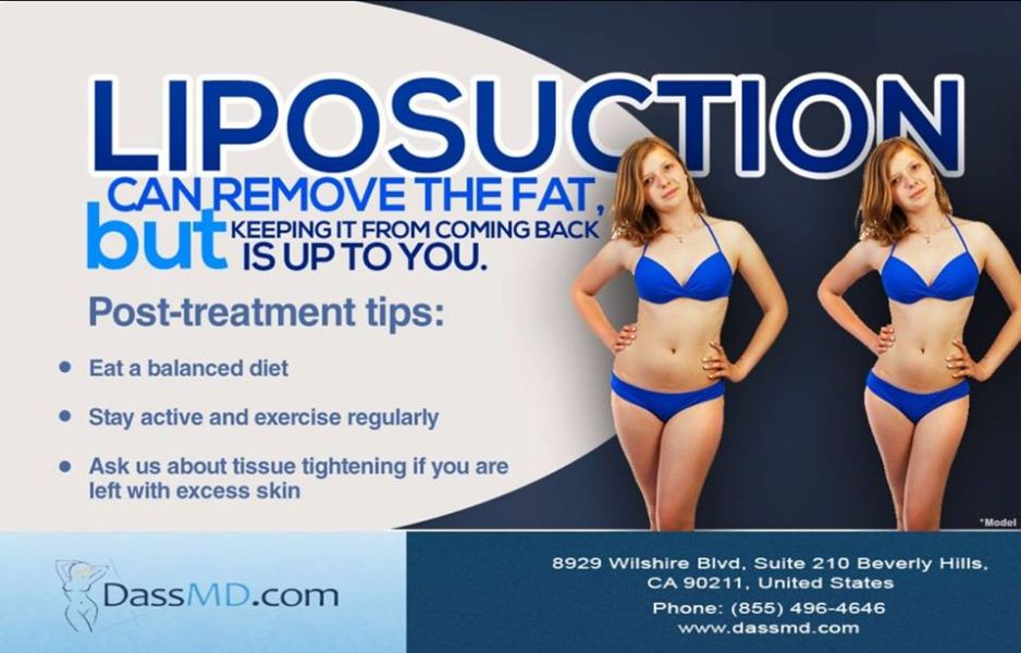 Liposuction Beverly Hills Near Me - Dr. Dennis Dass 