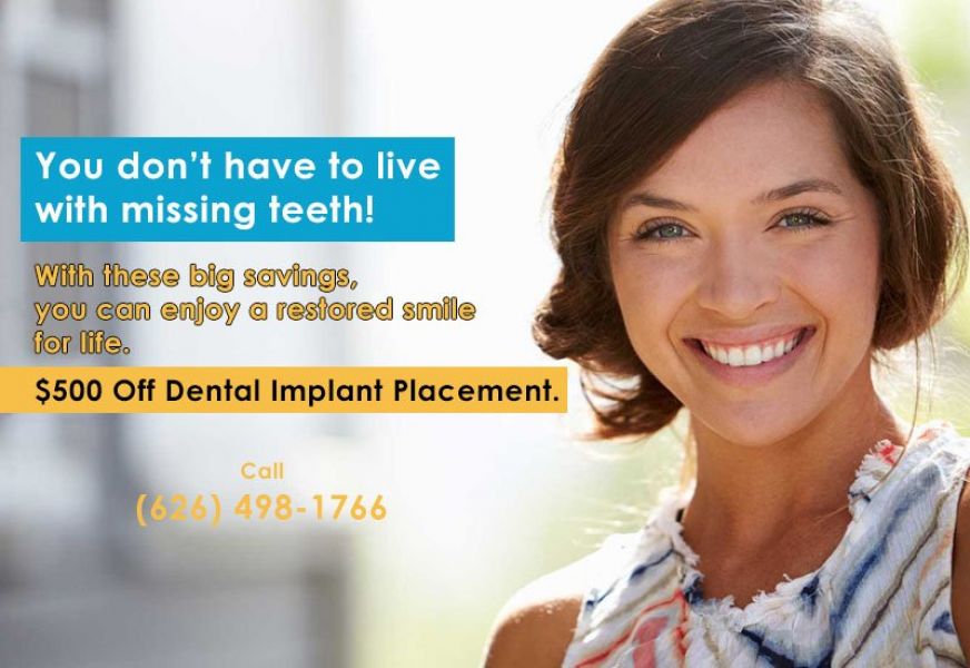 Composite or Tooth Colored Fillings Azusa Near To Me - Dr. Brianne Luu 