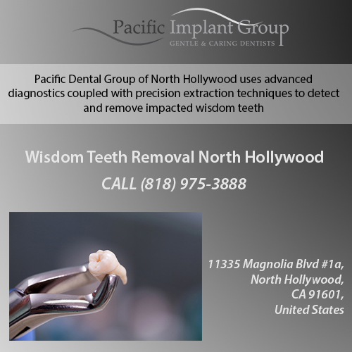 Wisdom Teeth Removal North Hollywood - 91601