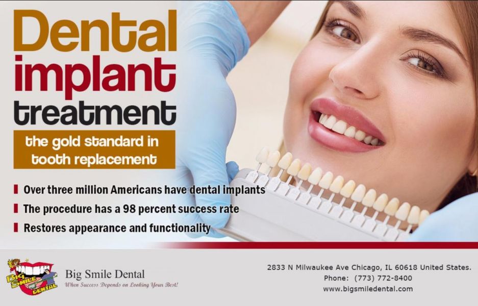 Affordable Dental Implants Chicago - Dr. Theodore M. Siegel 