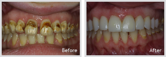 Certified Dentist Greenwood SC - Dr. Christopher Griffin
